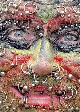 英国78岁老人全身穿孔241处破纪录