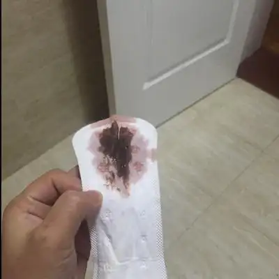 早上起来流了点褐色的血,和第一天大姨妈差不多,是不是要生了,肚子不