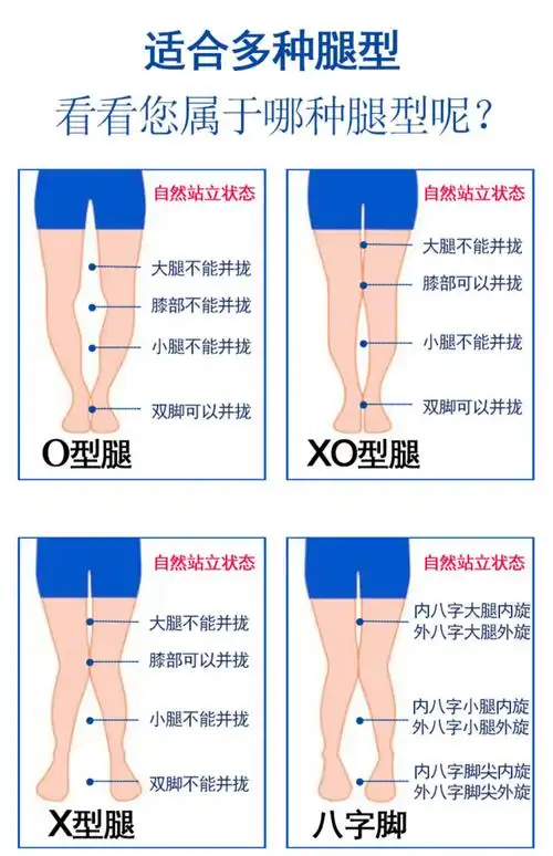 儿童绑腿矫正神器x腿型o型腿矫正小腿外翻矫正内外八字绑腿带青少年