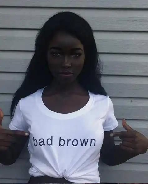 6个因"肤色特殊"走红的女孩