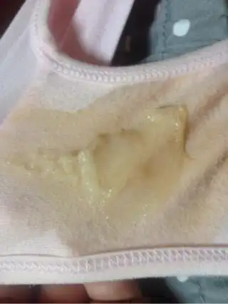 请问各位孕35775内裤有果冻状厚厚的分泌物正常吗