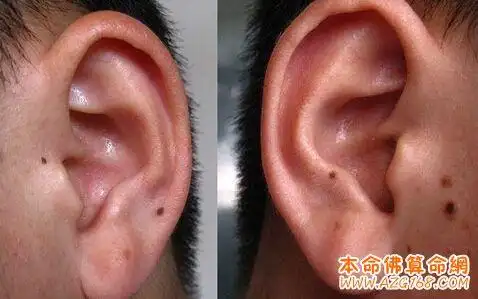 耳朵长痣好不好
