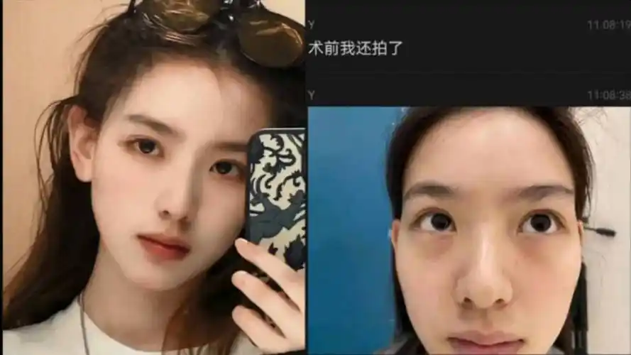 孙一宁被曝整容证据截图,脸上多处微调,网友吐槽脸不丑心丑