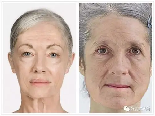 之前我们说过,骨骼在衰老的过程里有多个方面的变化