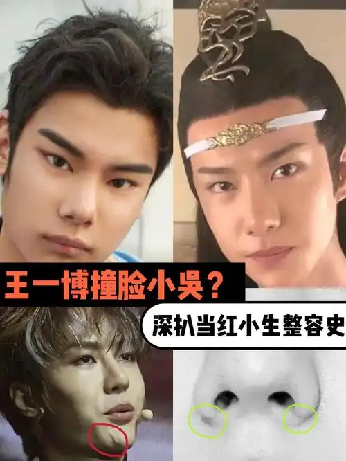 王一博撞脸小吴?深扒当红小生整容史