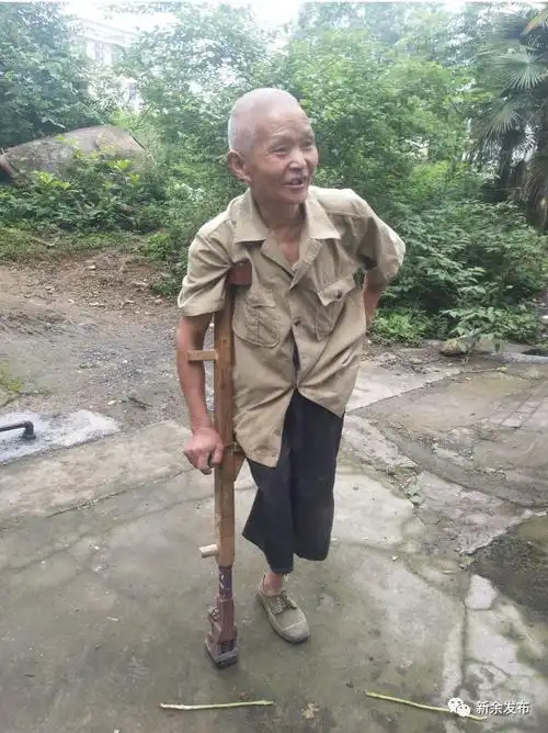 右腿的裤管空荡荡,说着说着,便咧开嘴笑了起来……眼前这位拄着拐杖的