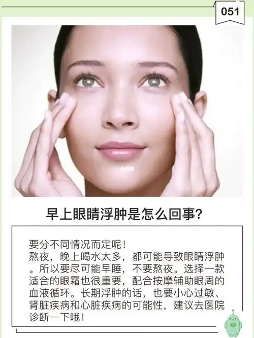 早上眼睛浮肿是怎么回事