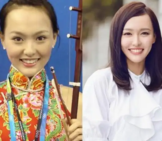 【图】唐嫣整容前的照片被扒出 前后差别大的吓人