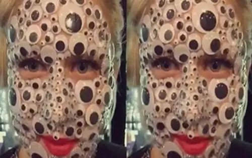 眼睛太大有什么烦恼