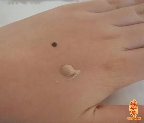 手上有痣算命_痣的位置_祥安阁风水网