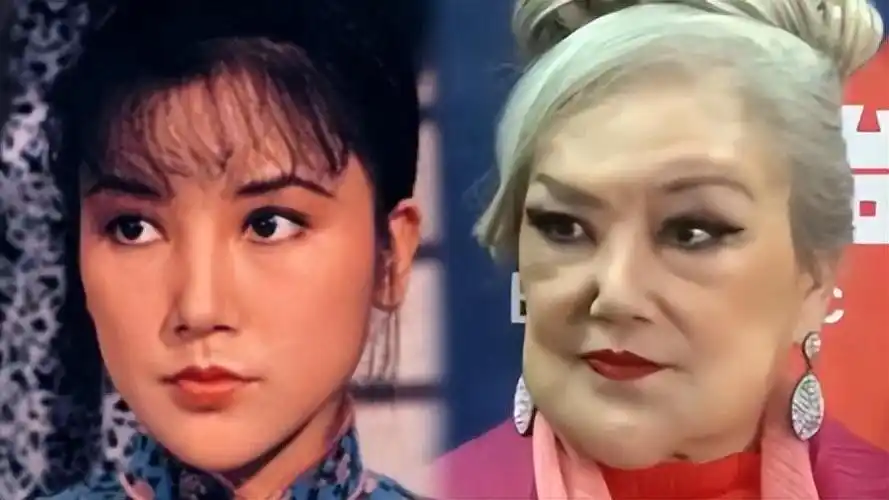 回顾7位整形毁掉的女星有人成玄冥二老有人整成僵尸脸