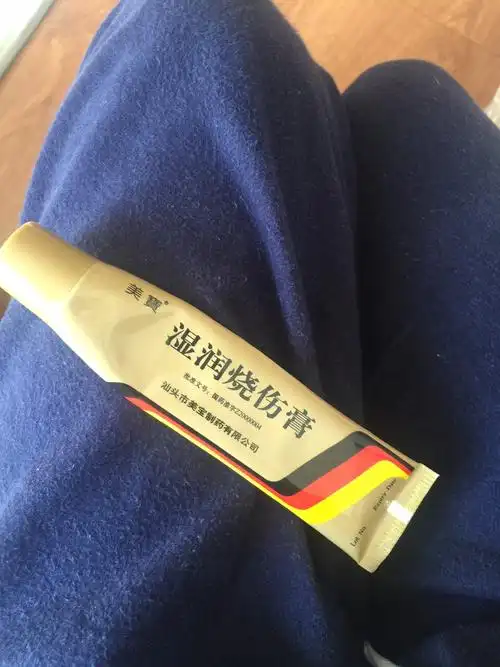 婴儿红屁屁神物美宝烫伤膏