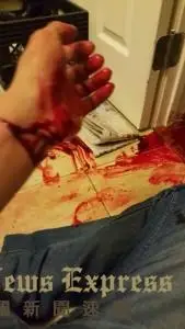 凌晨群聊,洛杉矶华男微信直播血腥切腕 (慎入)
