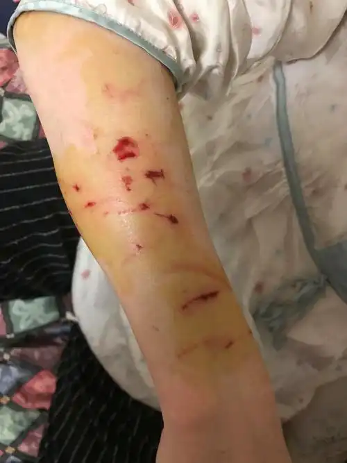 如何解决猫咬人/攻击人行为? - 知乎