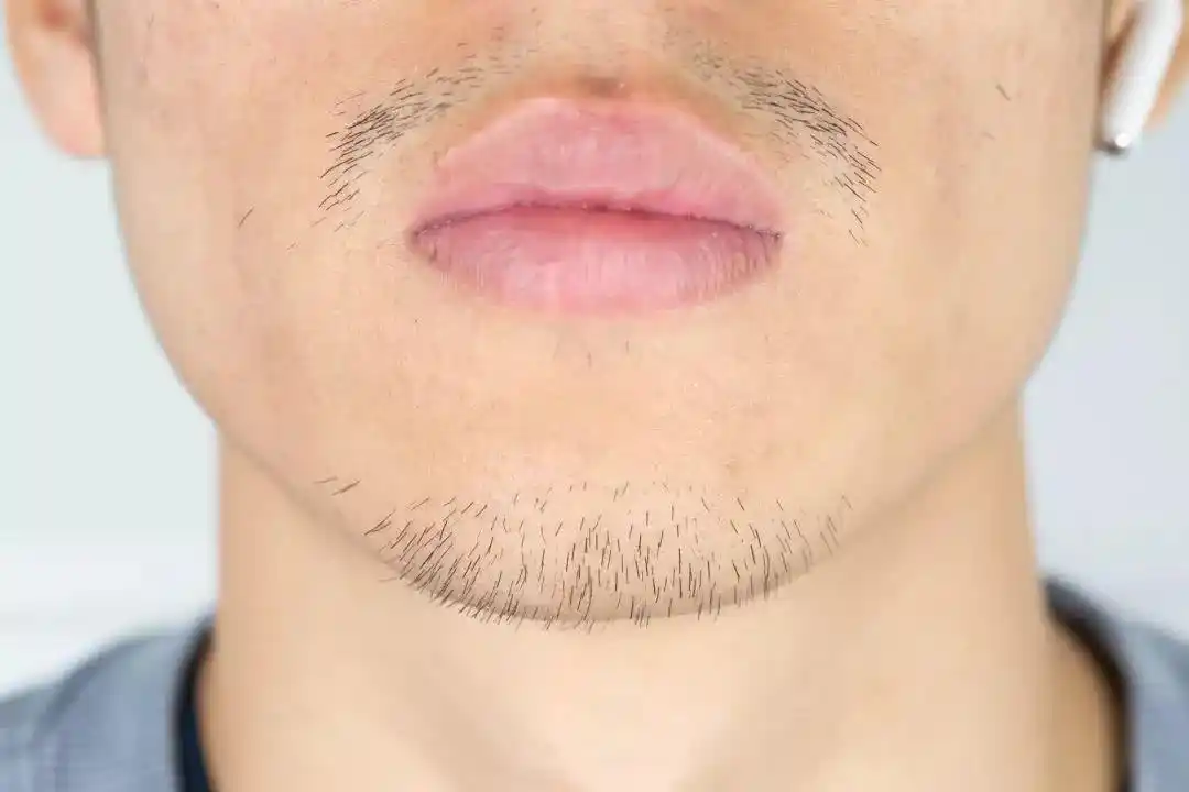 前一天刚刮了胡子,隔天就长出来了,胡须长得快,说明什么?