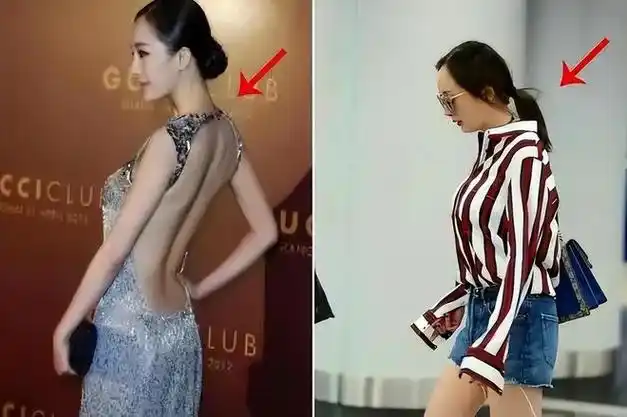 脖子短粗且前倾,侧面看着就像是龟丞相.归根结底,原因出在她的体态上.