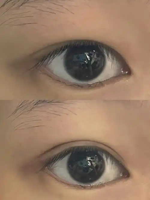 超隐形的双眼皮贴