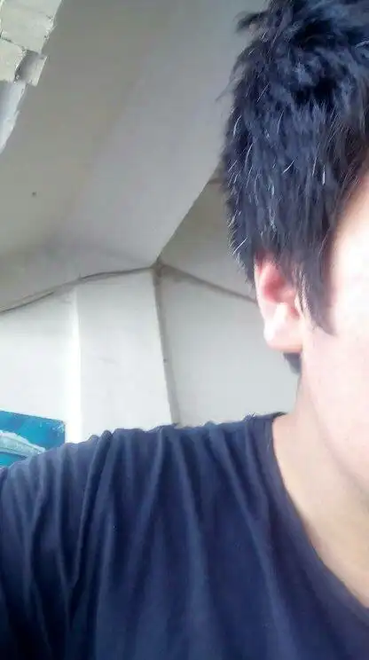 各位大哥大姐 请问白头发怎么治疗 才19岁啊 从以前的一根两根 到现在