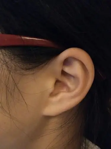 这种耳朵好嘛? 有什么危害吗?