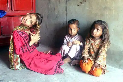 吓人幼年时摔倒脖子受伤从此扭曲90度歪头女童苦等手术11年