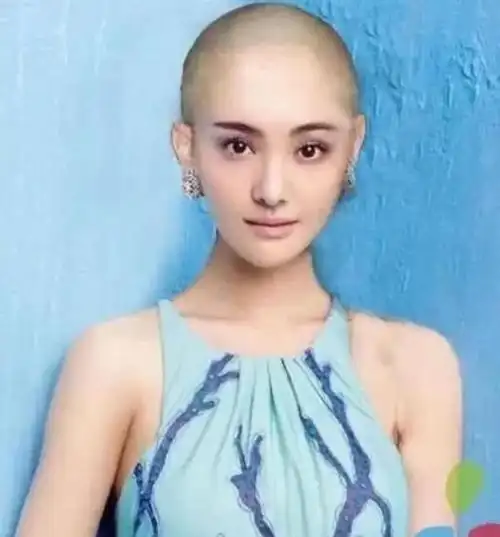 郑爽本身长相十分符合很多男观众心中"邻家女孩"的形象,此次郑爽光头