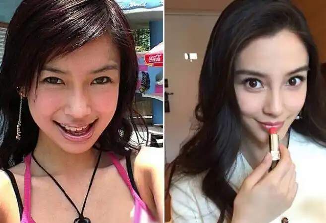 angelababy真的没整容!baby做整容鉴定 医生出具证明