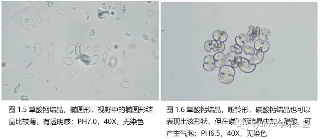 尿液结晶形态汇总