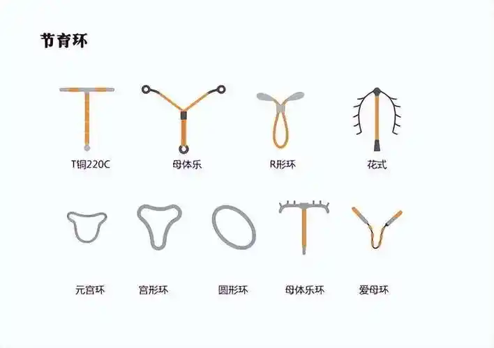 节育环的种类和材质有哪些(节育环的种类形状图片)