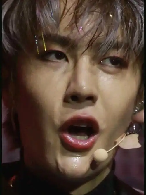 95王一博换头术 鼻翼疤痕太明显?