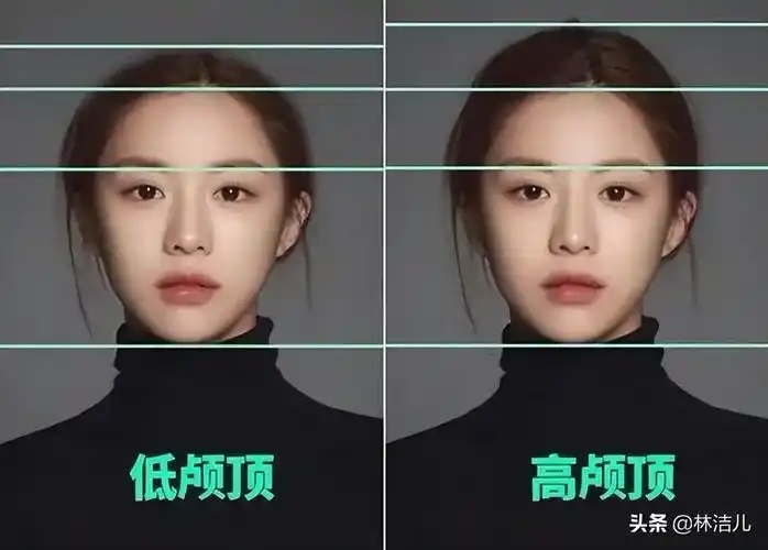 高颅顶是美人标准高颅顶面相