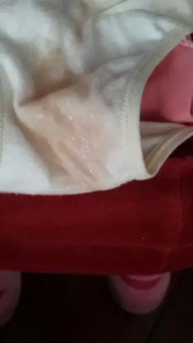 2-15预产期的今天见红了