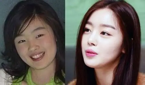 曝韩国女星整容前后对比照最后两个差别太大了!