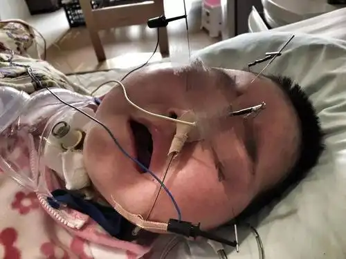 烟头烫四肢 刀割破手指 布包裹起来倒立:追溯情夫虐童案