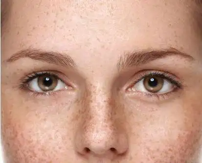 壹知肤:皮肤暗沉多斑的看过来!学会这几招,你也能"逆生长"!|黑色素|雀