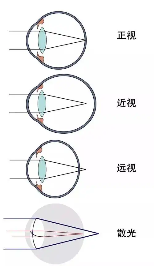 新视力自然疗愈带领大家一起来了解眼球结构