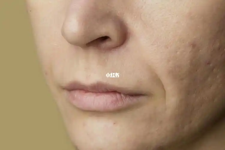 皮肤干燥容易长皱纹