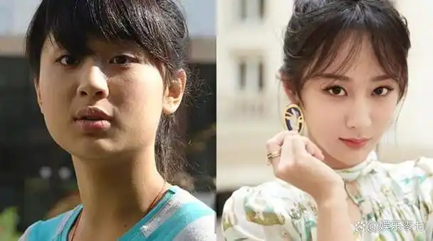 由于容貌发生了巨大变化,许多人开始对杨紫是否进行了整容