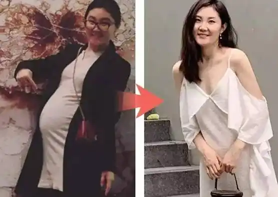 两个月后,去康复科检查,医生还惊奇地赞叹,娜娜的腹直肌分离和盆底肌