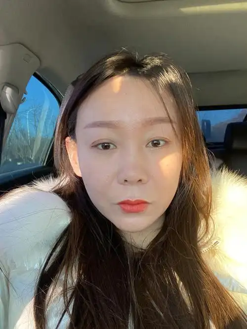 脂肪填充眼窝凹陷第72天各位宝子们