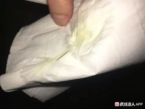 慎点,有图,这个是白带拉丝吗?造造显示明天排卵期,但是试纸还是浅浅的