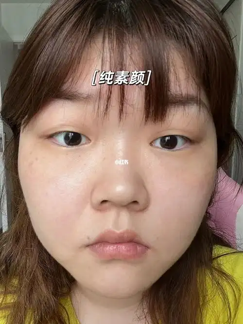 我这皮肤状态说我自己18岁不过分吧