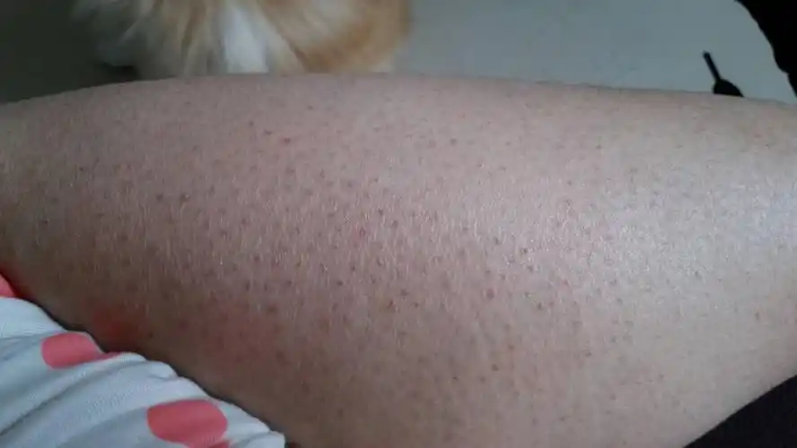 还是以后都是这样了?