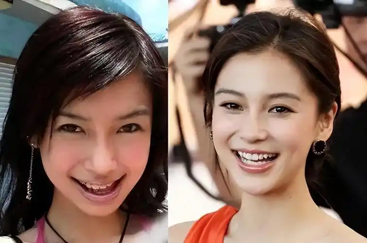 02杨颖——龅牙变女神