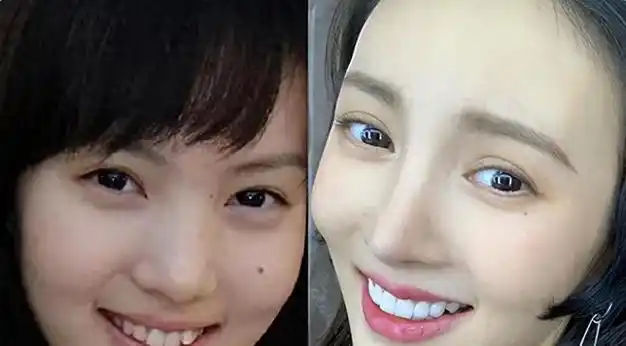 杨颖|女明星_网易订阅