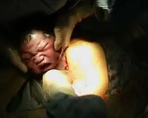 震撼:生孩子现场(组图)