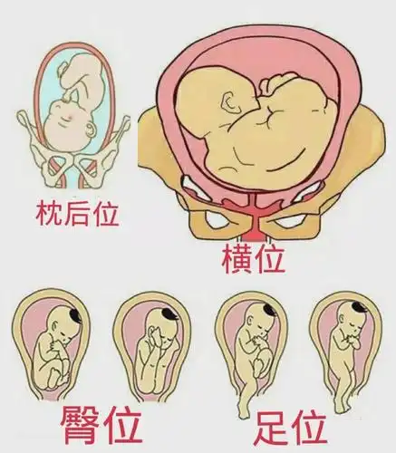 安军明教授谈穴位养生三十八至阴胎位不正怎么办