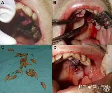 活体会生蛆吗?