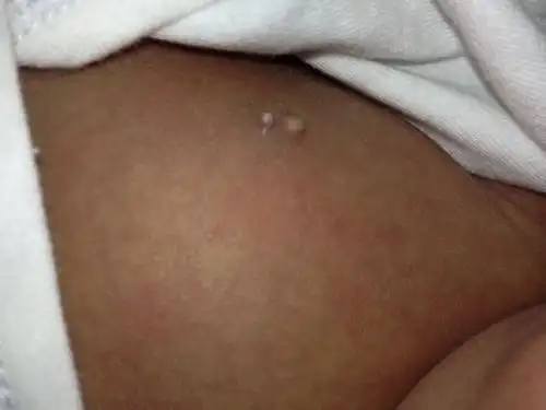 我确定那包在长大.请问这