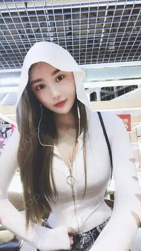 复合隆胸术后124天_乳房下垂矫正术后124天_假体隆胸术后124天_胸型