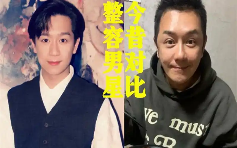 十位整容男星前后对比,陈浩民填充成马里奥,汪东城是个换头boy